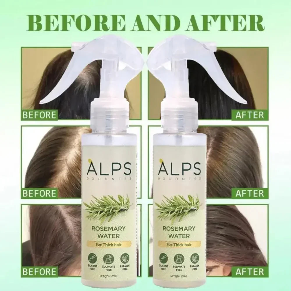 Rosemary Water Spray | For Hair Regrowth (Buy 1 Get 2 Free )