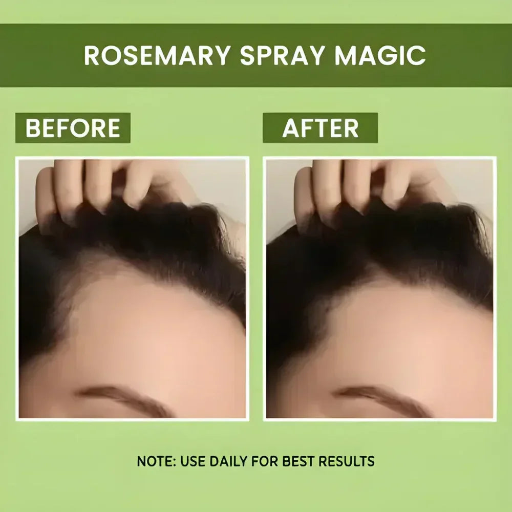 Rosemary Water Spray | For Hair Regrowth (Buy 1 Get 2 Free )