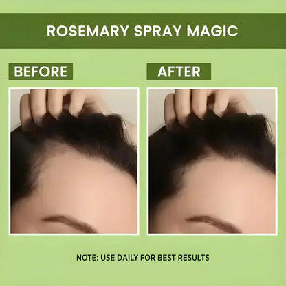 Rosemary Water Spray | For Hair Regrowth (Buy 1 Get 2 Free )